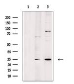 LYPLA1 Antibody in Western Blot (WB)