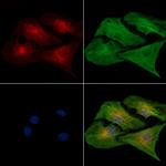 ALDH1B1 Antibody in Immunocytochemistry (ICC/IF)