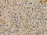 ALDH1B1 Antibody in Immunohistochemistry (Paraffin) (IHC (P))