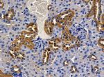 ALDH1B1 Antibody in Immunohistochemistry (Paraffin) (IHC (P))