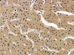 ALDH1B1 Antibody in Immunohistochemistry (Paraffin) (IHC (P))