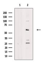 ALDH1B1 Antibody in Western Blot (WB)