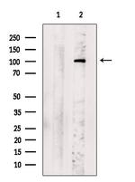 AMPD2 Antibody in Western Blot (WB)