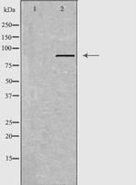 APLP2 Antibody in Western Blot (WB)