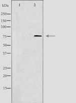 KAL1 Antibody in Western Blot (WB)