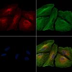 B3GALT4 Antibody in Immunocytochemistry (ICC/IF)