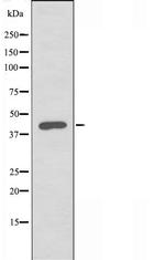 B3GALT4 Antibody in Western Blot (WB)