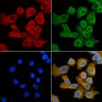 SLC27A5 Antibody in Immunocytochemistry (ICC/IF)