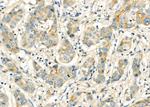 CHP2 Antibody in Immunohistochemistry (Paraffin) (IHC (P))