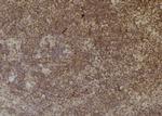 CBR3 Antibody in Immunohistochemistry (Paraffin) (IHC (P))