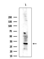 CBR3 Antibody in Western Blot (WB)