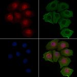 CNOT4 Antibody in Immunocytochemistry (ICC/IF)