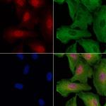 CEP290 Antibody in Immunocytochemistry (ICC/IF)