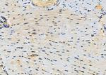 CLCN7 Antibody in Immunohistochemistry (Paraffin) (IHC (P))