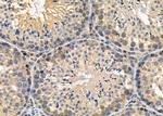 CLCN7 Antibody in Immunohistochemistry (Paraffin) (IHC (P))