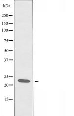 RCL Antibody in Western Blot (WB)