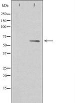 AGBL4 Antibody in Western Blot (WB)