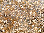 DOCK1 Antibody in Immunohistochemistry (Paraffin) (IHC (P))