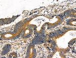 DOCK1 Antibody in Immunohistochemistry (Paraffin) (IHC (P))