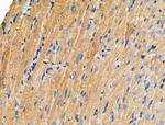 DOCK1 Antibody in Immunohistochemistry (Paraffin) (IHC (P))