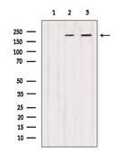 DOCK1 Antibody in Western Blot (WB)