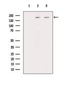 DOCK1 Antibody in Western Blot (WB)