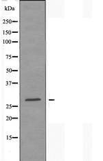 DHRS2 Antibody in Western Blot (WB)