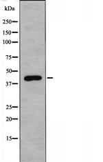 DHPS Antibody in Western Blot (WB)