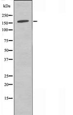 POLR3A Antibody in Western Blot (WB)