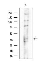 POLR3D Antibody in Western Blot (WB)