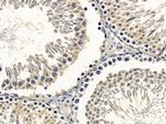 DNAI2 Antibody in Immunohistochemistry (Paraffin) (IHC (P))