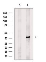 ELOVL4 Antibody in Western Blot (WB)