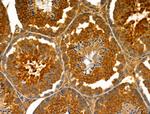 ENDOGL1 Antibody in Immunohistochemistry (Paraffin) (IHC (P))