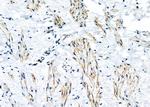 KDELR2 Antibody in Immunohistochemistry (Paraffin) (IHC (P))