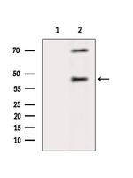 FUT3 Antibody in Western Blot (WB)