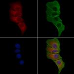 GCP4 Antibody in Immunocytochemistry (ICC/IF)