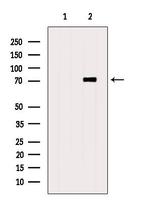 TSTA3 Antibody in Western Blot (WB)