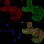 NMDAR2D Antibody in Immunocytochemistry (ICC/IF)