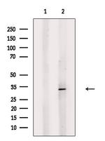 HLA-DOB Antibody in Western Blot (WB)