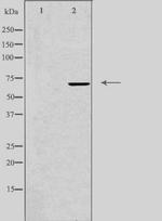 IQCB1 Antibody in Western Blot (WB)