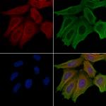 LIPI Antibody in Immunocytochemistry (ICC/IF)