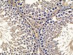 LIPI Antibody in Immunohistochemistry (Paraffin) (IHC (P))