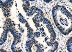 MRPS30 Antibody in Immunohistochemistry (Paraffin) (IHC (P))