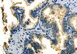 MRPS30 Antibody in Immunohistochemistry (Paraffin) (IHC (P))