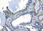 MRPS30 Antibody in Immunohistochemistry (Paraffin) (IHC (P))