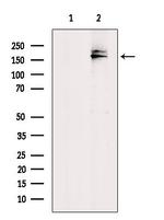 MRP7 Antibody in Western Blot (WB)