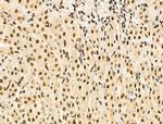 MDFI Antibody in Immunohistochemistry (Paraffin) (IHC (P))