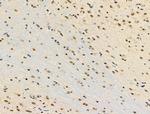 MDFI Antibody in Immunohistochemistry (Paraffin) (IHC (P))