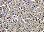 PTGR1 Antibody in Immunohistochemistry (Paraffin) (IHC (P))