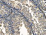 PTGR1 Antibody in Immunohistochemistry (Paraffin) (IHC (P))